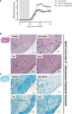 suppresses experimental autoimmune encephalomyelitis